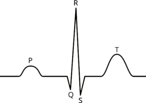 EKG-clean