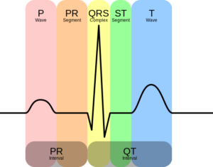 EKG-kompleks-png_