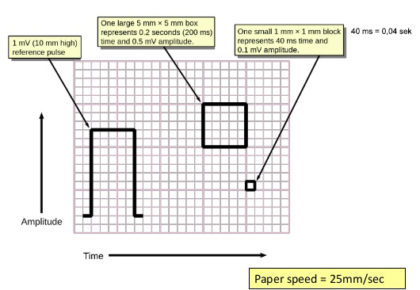 EKG-guide For Enhver Ambulanceredder | Ambulancevejen