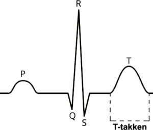 sinus-rytme-t-takken-png