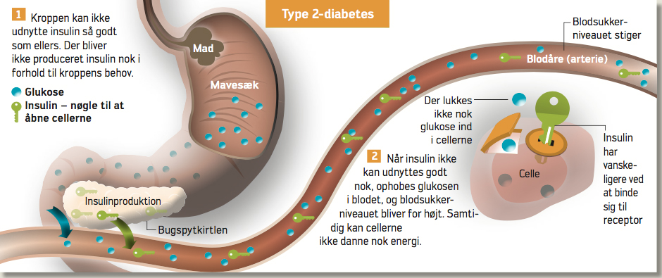 Hvordan det nu det var med: Diabetes insulin – Ambulancevejen